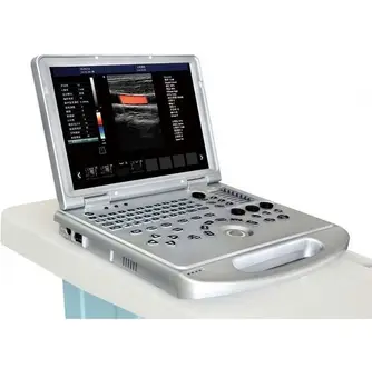 ultragarso 4d ultragarsinio skenerio mobiliojo tipas 4d spalva doplerio nešiojamas ultragarsinis skeneris